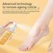 NuoWeiTong Facial Serum Foot Exfoliating Spray Gently Exfoliates Dead Skin Cleans Deodorizes Removes Calluses Keeps Foot Skin Soft And 60ML