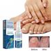 Dreparja Antifungals Nail Treatments Spray In Medicals -Nail Antifungals Liquid Solution Antifungals That Can Lead to Nail & Athlete s Foot 30ml