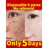 Poren schrumpfen Serum Gesicht entfernen große Poren Straffung Reparatur großer Poren Gesichts poren