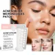 72pcs/box Face Blemish Invisible Patches For Pimples Sticker Microneedle Acne Cleanser