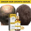 Ginger Hair Care Essential Oil 7 Day Improves Scalp Environment Hair Loss Treatment Hair Growth Care