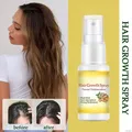 Hairloss Hair Head Hair Care Hair Laser Growth Alopecia Hair Treatment for Women Growth Tool Ginseng