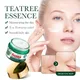 50g Tea Tree Acne Removing and Oil Control Face Cream Acne Printing Facial Anti Acne Skin Care