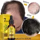 Ginger Fast Hair Growth Serum Oil for Man Women Anti-loss Hair Regrowth Essential Oil Repair Damaged