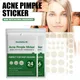 New Press Edge Acne Patch Invisible Concealer Acne Patch Light Breathable Suction Pus Suction Liquid