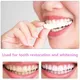 Sdotter 2Pcs/Set Silicone Teeth Whitening Teeth Cover Teeth Braces Simulation Denture Upper Teeth