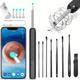 Ear Cleaner With Camera, Earwax Remover With 4 Spoons And 8 Earpick Tools, Earwax Remover With 1080p, Rechargeable Earwax Remover For Adults