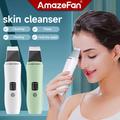 AmazeFan – Machine de nettoyage en profondeur du visage, gommage de la peau, Machine de beauté pour le nettoyage des pores du visage