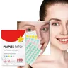 200pcs Repair Acne Patch Facial Skin Care Fade Blemishes Pimple Marks Closed Acne Blemishes Cover