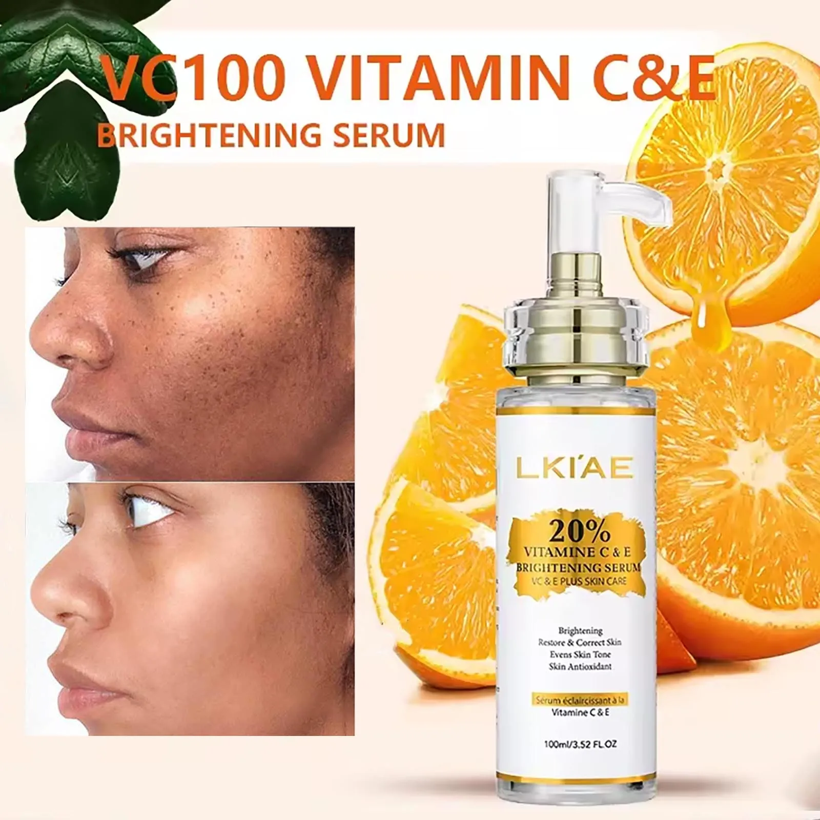 AILKE Vitamin C & E Super Brightening Konzentriertes Serum, aufhellend, feuchtigkeitsspendend, saubere Haut, reduziert dunkle Flecken, 100 ml/3,52 oz Image