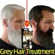 Herbal Anti-grey Hair Treatment Serum Cream White To Black Permanent Repair Natural Color Nourish Scalp Hair Care Products