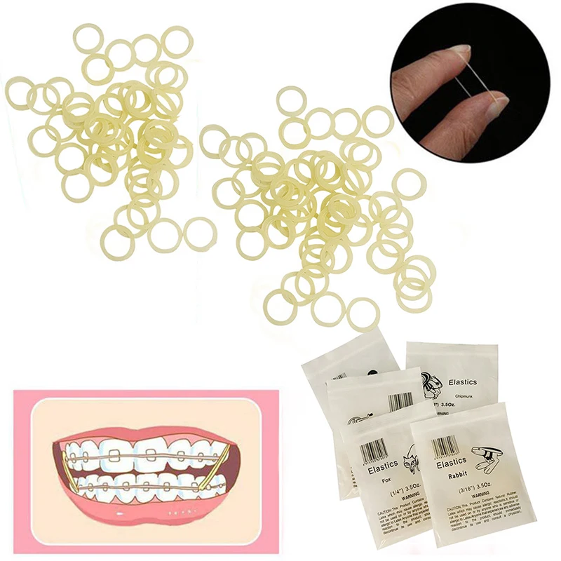 100 Stück gelbe Dental-Elastomer-Latexringe, Zahnspangen, Zahngummibänder, ungiftiges Material 3,5 Unzen Zahngummibänder Image