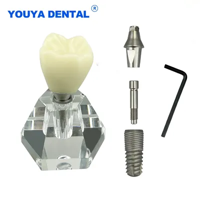 Dental Crystal Implant Model Teeth Communication Transparent Dental Practice Removable Dentures