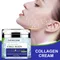 YOUNGCOME Collagen facial moisturizer,Moisturizer Anti Wrinkle Retinol Moisturizer Face Cream Anti