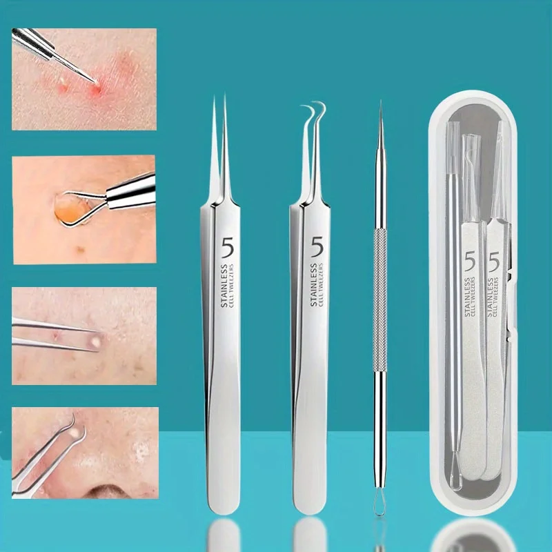 Pickel-Extraktionswerkzeuge, Mitesser-Entferner, Pickel-Popper, Akne-Entfernungsset, riskfreie Behandlung für Makel, Mitesser-Pinzette Image