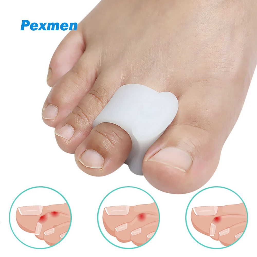 Pexmen 2-teilige Bunion-Korrektoren für Damen und Herren, Spacer für große Zehen, Schmerzlinderung, Gel-Pads, glätten und ausrichten überlappende Zehen Image