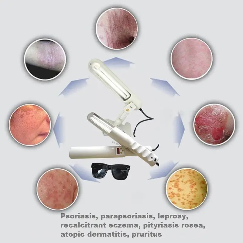 UV 311nm Ultraviolet Phototherapy Device Uses Philips Lamp UVB To Treat Vitiligo, Psoriasis, White Spots, Skin Diseases 110v Us Plug