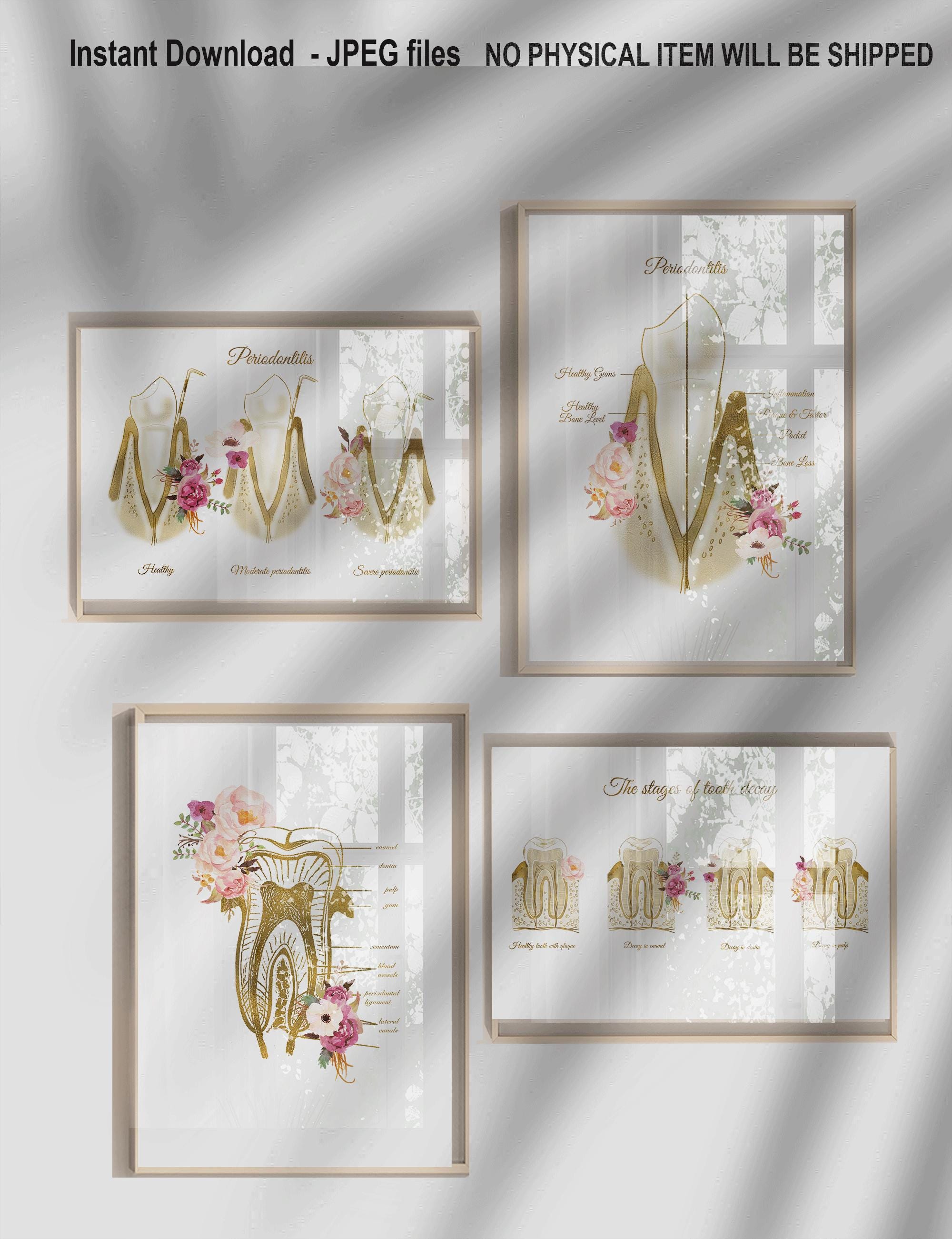 Set di decorazioni murali per dentisti / Stampe floreali sull'anatomia dei denti / Decorazioni per studio dentistico / Eleganti opere d'arte per denti
