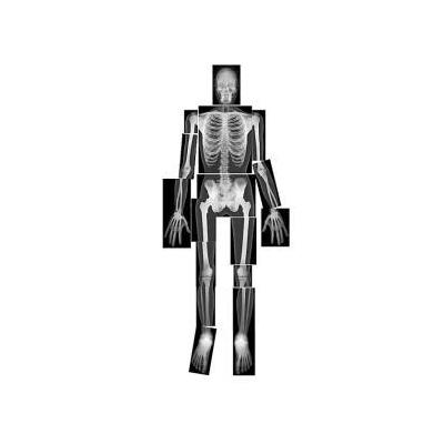 Roylco True to Life Human X-Rays Toy
