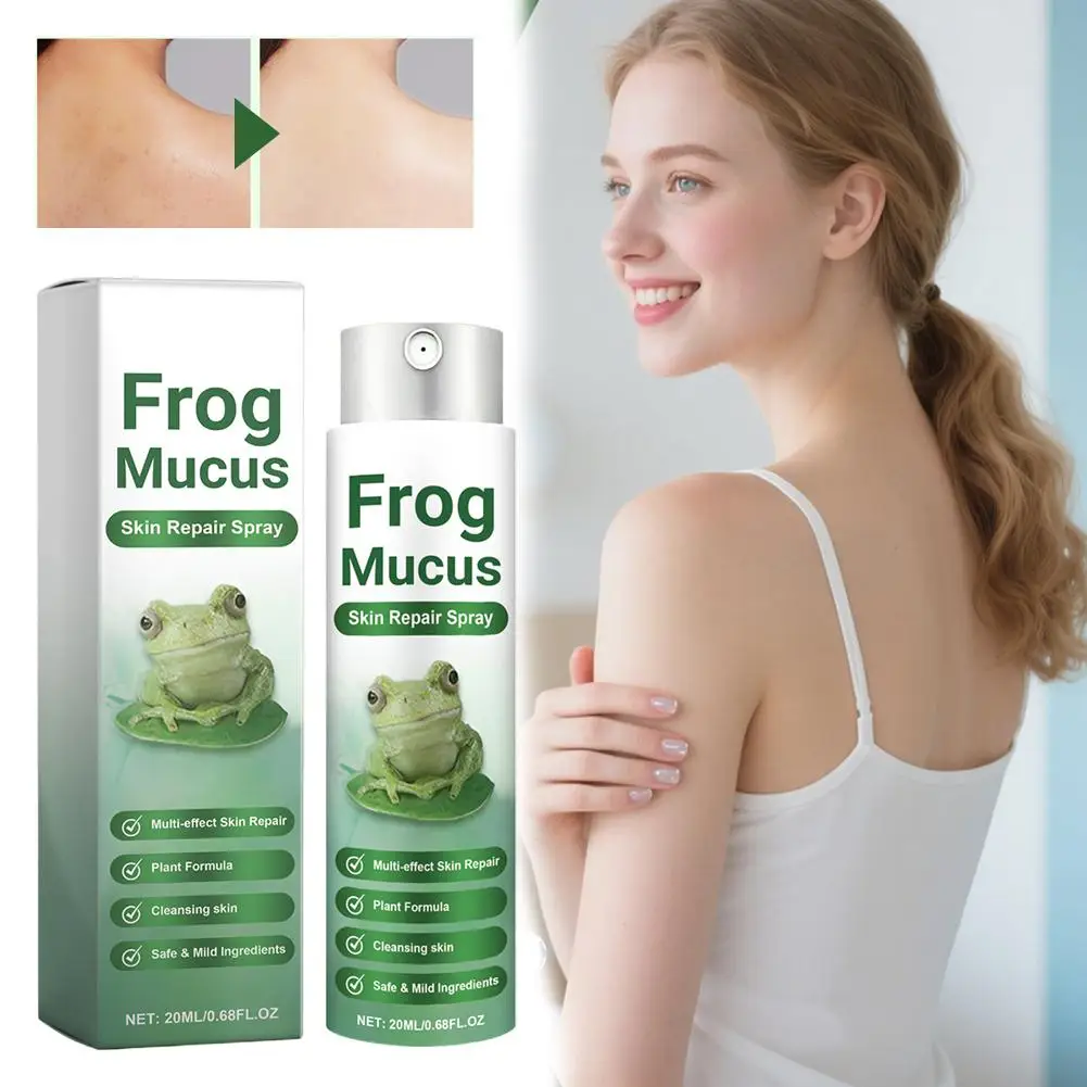 Frog Mucus Skin Repair Spray Astringent Facial Toner steuert Öl, verkleinert die Poren für verstopfte Poren, feuchtigkeitsspendender Gesichtswasser Image