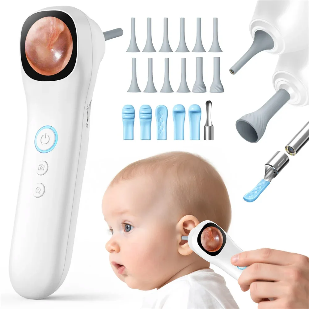 Digitale Ohrkamera mit 1,21 Zoll IPS-Bildschirm 1080p HD Intelligente visuelle Ohrenpflege mit Werkzeug für die Gesundheit von Ohren/Nasen/Mund/Haustieren/Hautpflege Image