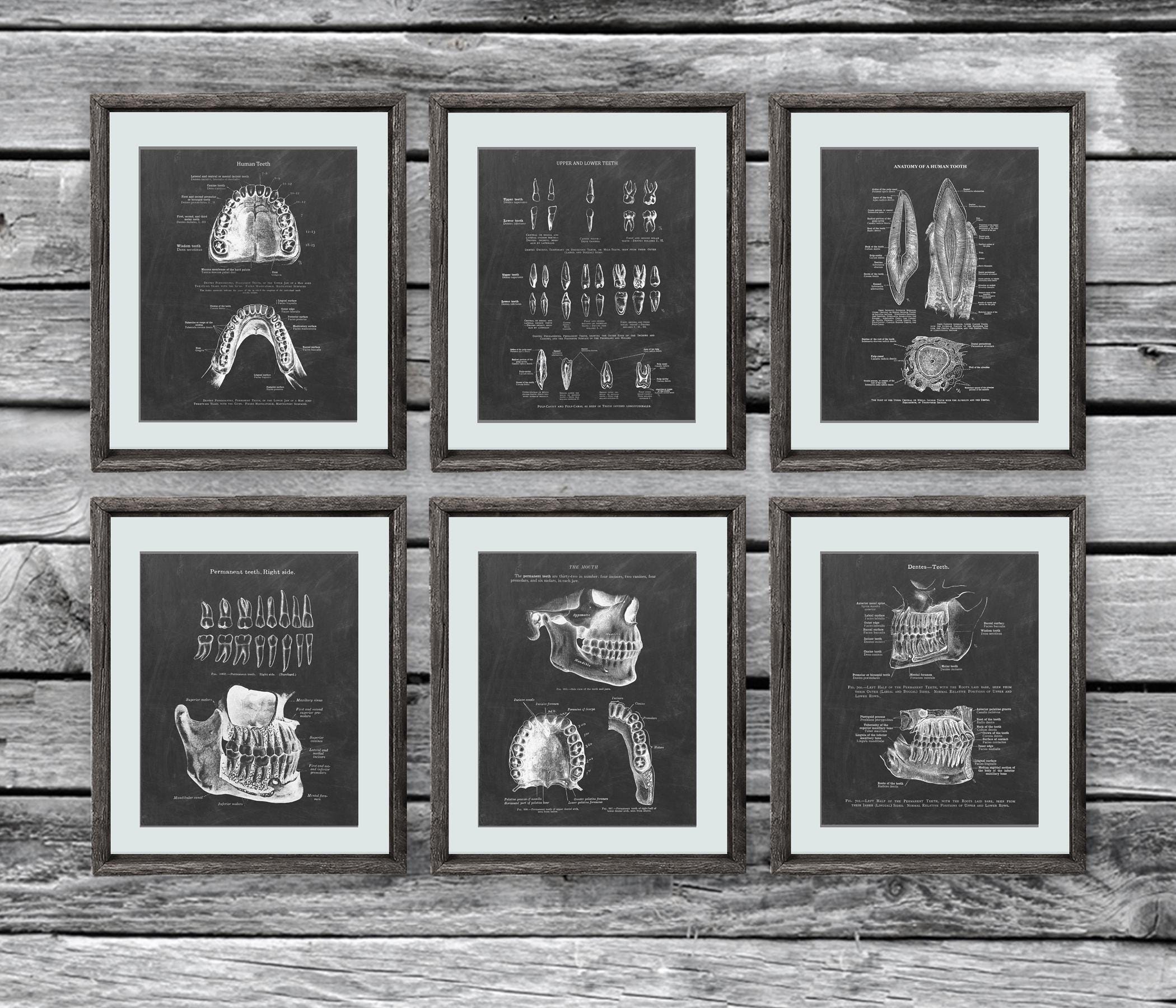 Set di 6 stampe artistiche senza cornice sull'anatomia dei denti - Regali per dentisti - Decorazioni murali per studi dentistici