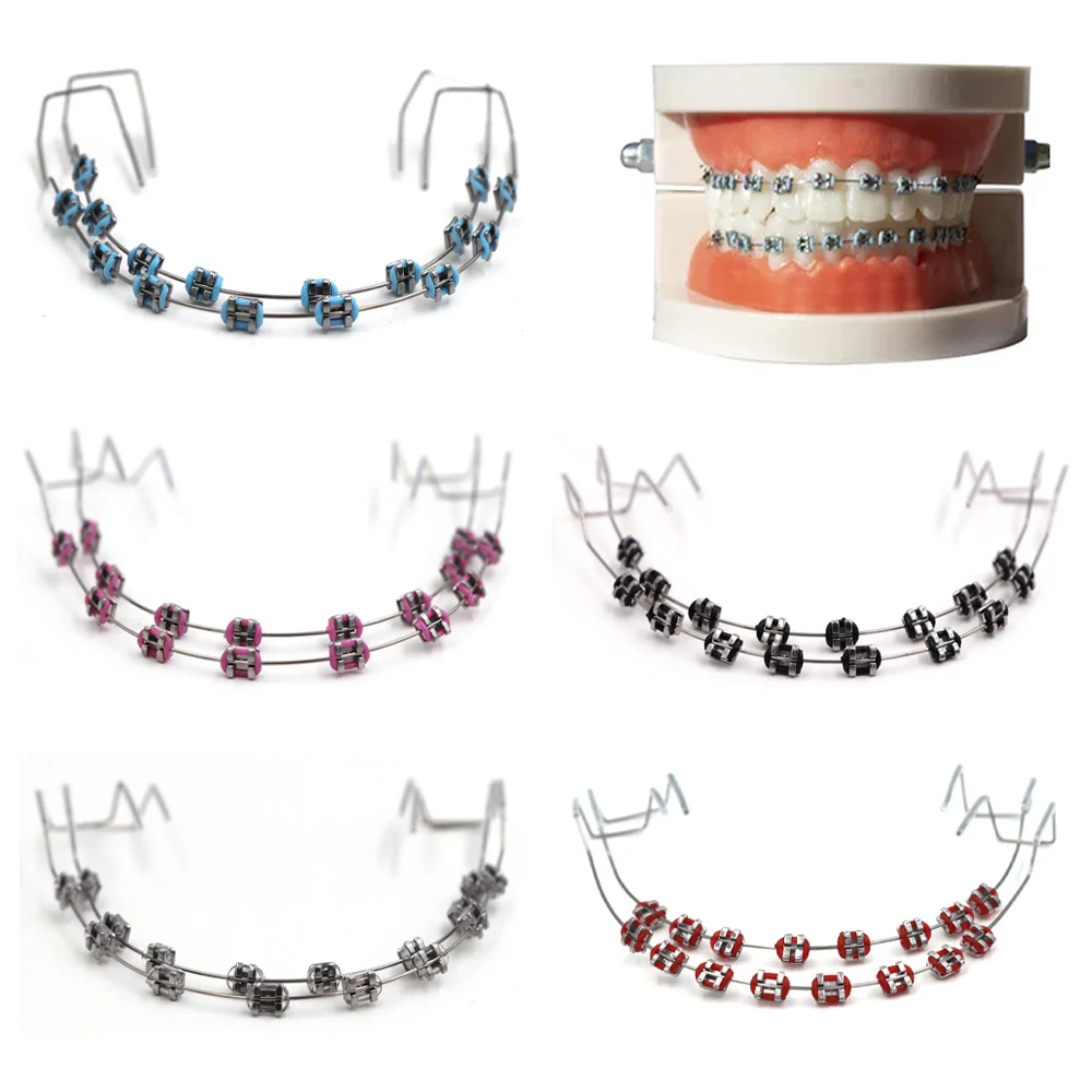 Modische Zahnspangen, 1 Paar, bunte temporäre Zahndekoration mit Metalldrähten, Metallhalterung, kieferorthopädische Ligaturbinder, hohe Qualität Image