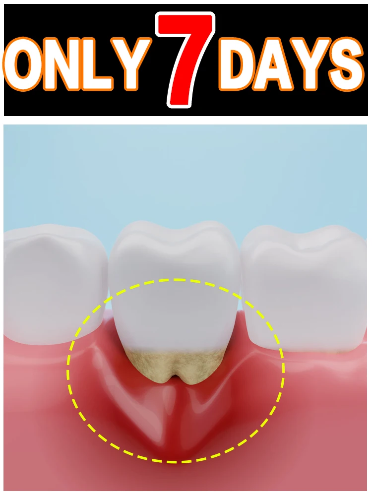 7 Tage Zahnfleischregeneration und Zahnschutz Image