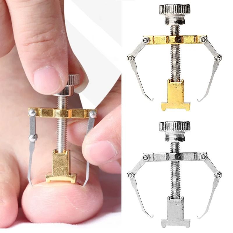 Stainless Steel Ingrown Toenail Corrector Set gold