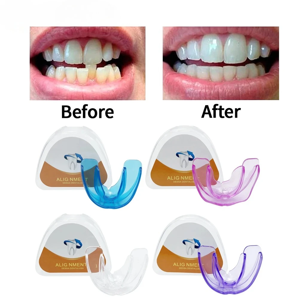 Kieferorthopädische Zahnspangen Zahnspangen Lächeln Zähne Ausrichtung Trainer Instanted Silikon Zahnhalter Mundschutz Zahnspangen Zahn 2026 Image