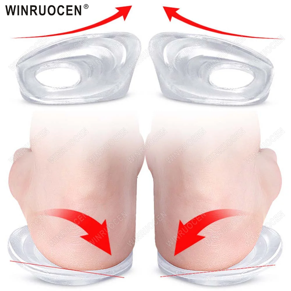 WINRUOCEN XO Beinform-Korrektur-Einlegesohlen, gefallener Fußgewölbe, unterstützt elastische orthopädische Fersenpolster, Fußhaltungskorrektur für Männer und Frauen Image