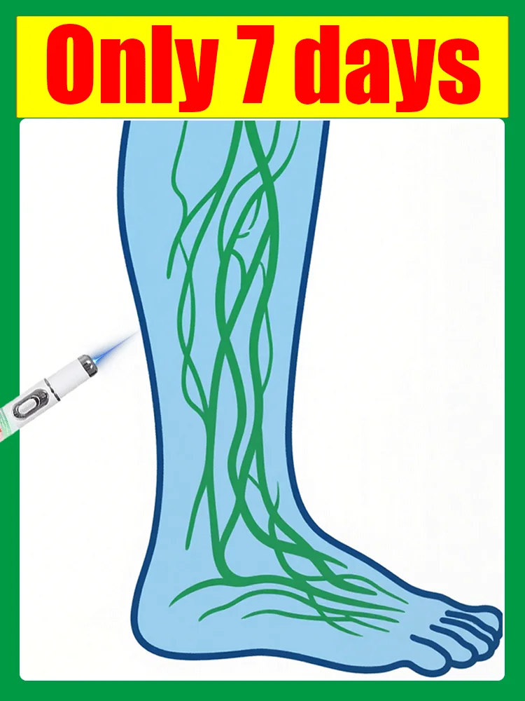Laser sagt auf Spinnenbeine Krampfadern in 7 Tagen Image