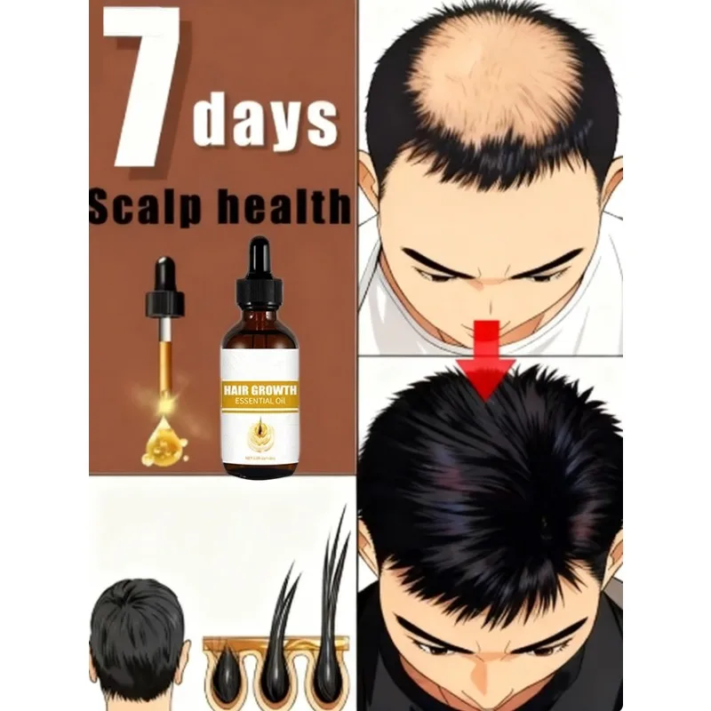 Hair Roller Serum Sanft nährt die Kopfhaut und pflegt die weichmachende Haarpflege Daily Care Scalp Serum