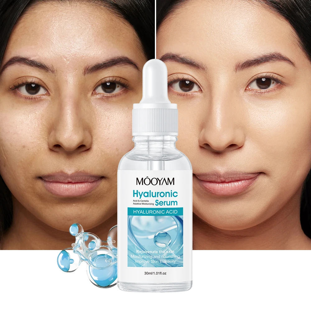 Siero Viso MOOYAM con Acido Ialuronico e Centella Asiatica 30ml Idratante Anti-Età per la Cura della Pelle Etichetta Privata