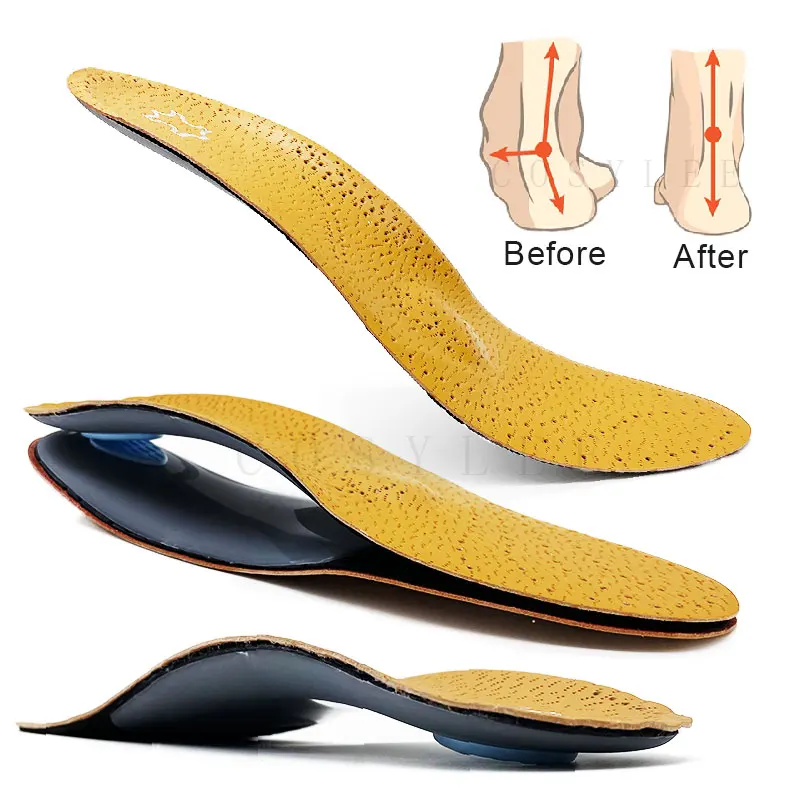 Orthesen-Einlegesohle für Plattfüße, Fußgewölbeunterstützung, orthopädische Lederschuhe, Sohle für Männer und Frauen, O/X-Beinkorrigierte Einlegesohlen Image