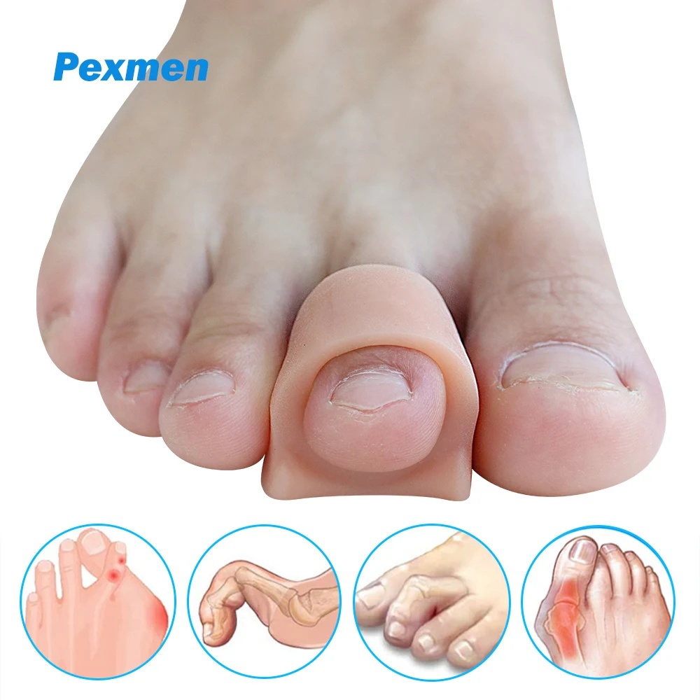Pexmen 2/4/10 Stück weiche Gel-Zehenspreizer, Zehenabstandshalter, Bunion Corrector für überlappende Hallux Valgus und Hammerzehen-Fußpflegewerkzeug Image
